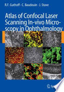 Atlas of Confocal Laser Scanning In-vivo Microscopy in Ophthalmology [E-Book] /