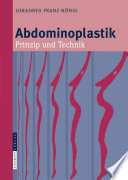 Abdominoplastik [E-Book] : Prinzip und Technik /
