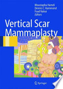 Vertical Scar Mammaplasty [E-Book] /