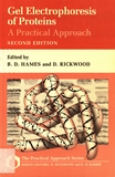 Gel electrophoresis of proteins : a practical approach /