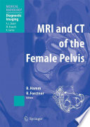 MRI and CT of the Female Pelvis [E-Book] /