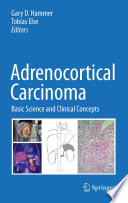 Adrenocortical Carcinoma [E-Book] : Basic Science and Clinical Concepts /