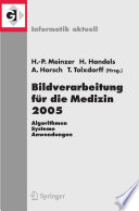 Bildverarbeitung für die Medizin 2005 [E-Book] : Algorithmen — Systeme — Anwendungen Proceedings des Workshops vom 13. – 15. März 2005 in Heidelberg /