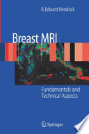 Breast MRI [E-Book] : Fundamentals and Technical Aspects /