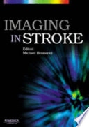 Imaging in stroke /