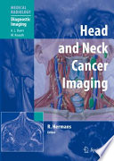 Head and Neck Cancer Imaging [E-Book] /