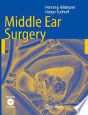 Middle Ear Surgery [E-Book] /