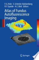 Atlas of Fundus Autofluorscence Imaging [E-Book] /
