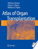 Atlas of Organ Transplantation [E-Book] /