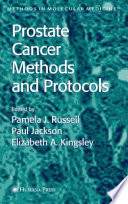 Prostate Cancer Methods and Protocols [E-Book] /