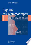 Signs in MR-Mammography [E-Book] /