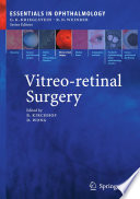 Vitreo-retinal Surgery [E-Book] /