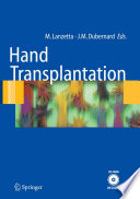 Hand Transplantation [E-Book] /