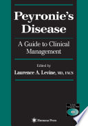 Peyronie’S Disease [E-Book] : A Guide to Clinical Management /