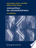 Osteosynthese der Schenkelhalsfraktur [E-Book] : Ein Bildatlas /