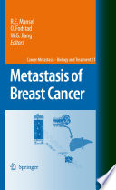 Metastasis of Breast Cancer [E-Book] /