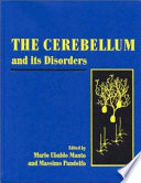 The cerebellum and its disorders /