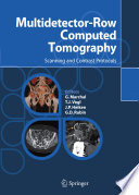 Multidetector-Row Computed Tomography [E-Book] : Scanning and Contrast Protocols /
