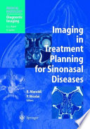 Imaging in Treatment Planning for Sinonasal Diseases [E-Book] /