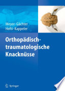 Orthopädisch-traumatologische Knacknüsse [E-Book] /