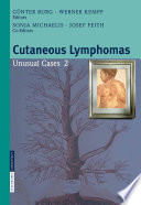 Cutaneous Lymphomas Unusual Cases 2 [E-Book] /