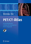 PET/CT Atlas [Compact Disc] : ein interdisziplinärer Leitfaden der onkologischen PET/CT-Diagnostik /
