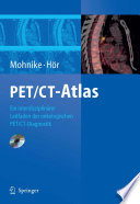 PET/CT-Atlas [E-Book] : Ein interdisziplinärer Leitfaden der onkologischen PET/CT-Diagnostik /