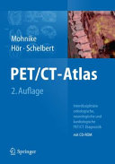 PET/CT-Atlas [E-Book] : Interdisziplinäre onkologische, neurologische und kardiologische PET/CT-Diagnostik /