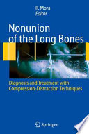 Nonunion of the Long Bones [E-Book] : Diagnosis and treatment with compression-distraction techniques /