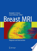Breast MRI [E-Book] : Diagnosis and Intervention /