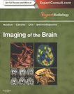 Imaging of the brain /