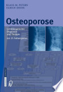 Osteoporose [E-Book] : Leitliniengerechte Diagnostik und Therapie /