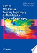 Atlas of Non-Invasive Coronary Angiography by Multidetector Computed Tomography [E-Book] /