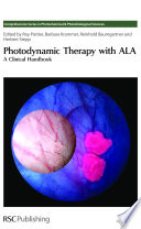 Photodynamic therapy with ALA : a clinical handbook  / [E-Book]