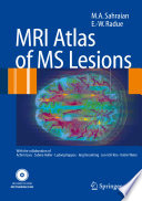 MRI Atlas of MS Lesions [E-Book] /
