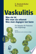 Vaskulitis [E-Book] : Was sie ist - Wie man sie erkennt - Was man dagegen tun kann, Ein Ratgeber für Patienten und Angehörige /