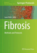 Fibrosis [E-Book] : Methods and Protocols /