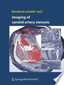 Imaging of Carotid Artery Stenosis [E-Book] /