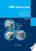 MRI of the Liver [E-Book] : Imaging Techniques, Contrast Enhancement, Differential Diagnosis /