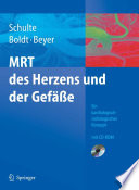 MRT des Herzens und der Gefäße [E-Book] : Indikationen — Strategien — Abläufe — Ergebnisse Ein kardiologisch-radiologisches Konzept /