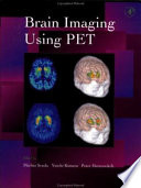 Brain imaging using PET /