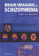Brain imaging in schizophrenia : insights and applications /