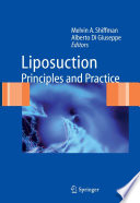 Liposuction [E-Book] : Principles and Practice /