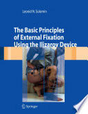 The Basic Principles of External Fixation Using the Ilizarov Device [E-Book] /