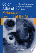 Color Atlas of Melanocytic Lesions of the Skin [E-Book] /