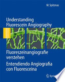 Understanding Fluorescein Angiography [E-Book] /