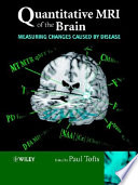 Quantitative MRI of the brain : measuring changes chaused by disease /