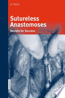 Sutureless anastomoses [E-Book] / Secrets for Success