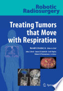 Treating Tumors that Move with Respiration [E-Book] /