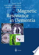 Magnetic resonance in dementia /